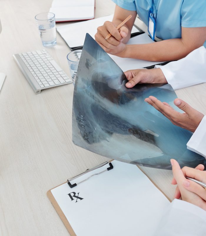 physicians-examining-lungs-x-ray-YZQZ8TH